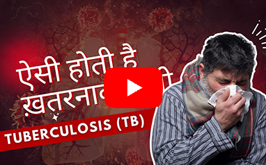 Tuberculosis | Dr. Charu Agrawal | X-Ray | TB Disease