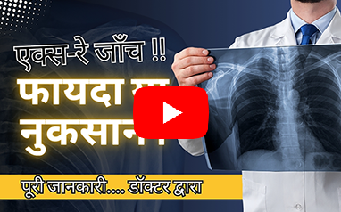 Know Your Test | X Ray kyo karwaya jaata hai | Consultant Radiologist