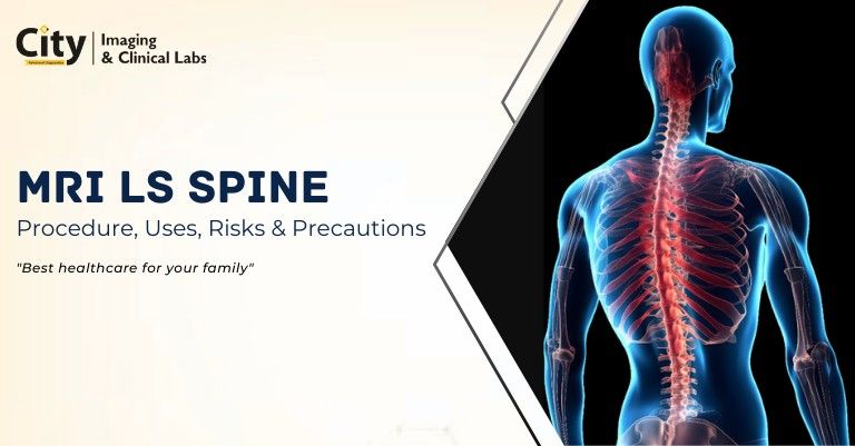An Complete Guide on MRI LS Spine