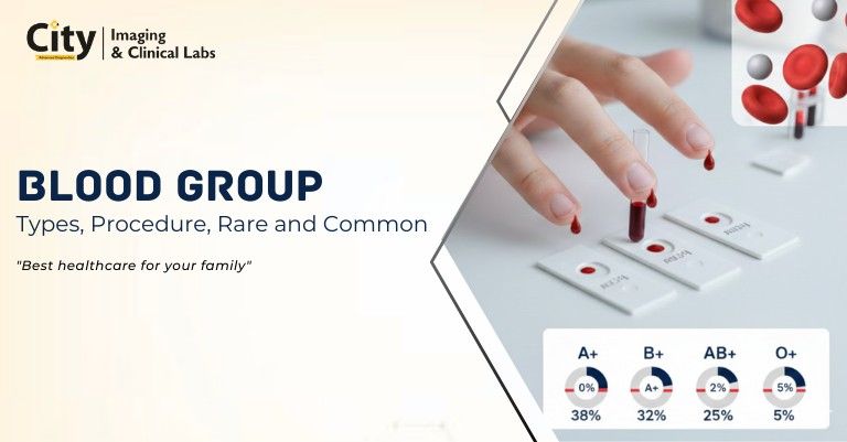 Blood Group: Types, Procedure, Rare and Common