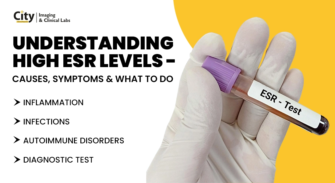 Doctor analyzing blood test report showing high ESR levels