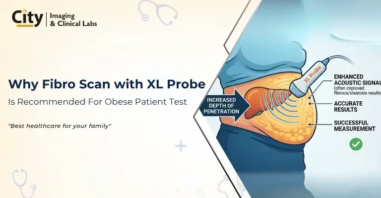 Fibro Scan with XL Probe