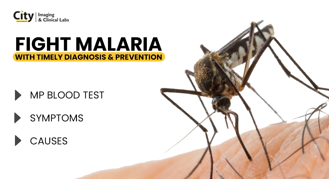 Malaria parasite slide test, malaria blood test name, cause of malaria, sign and symptoms of malaria