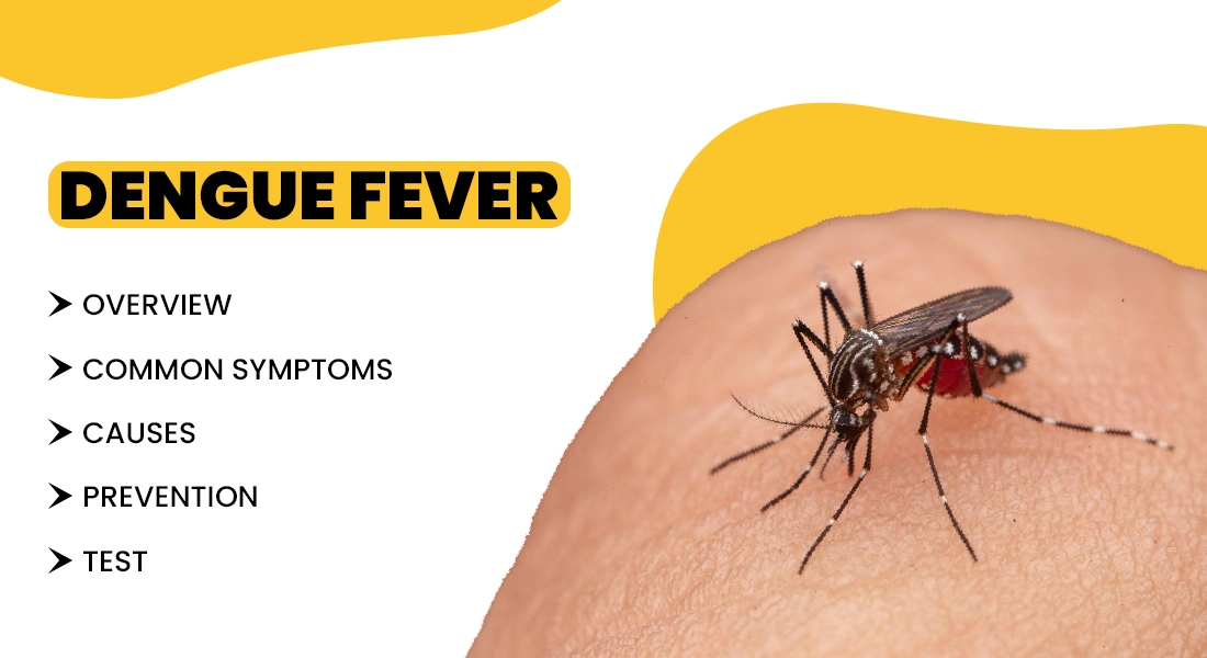 How To Treat dengue Fever symptoms and casues