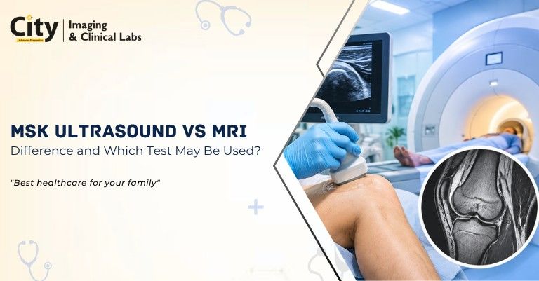 MSK Ultrasound vs MRI: What Is the Difference and Which Test May Be Used?