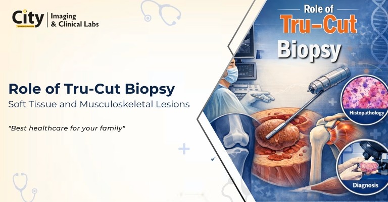 Role of TruCut Biopsy in Diagnosing Soft Tissue and Musculoskeletal Lesions