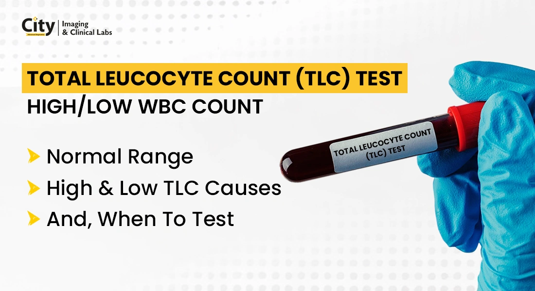 What is TLC in Blood Test, High TLC Symptoms, Normal Range and Causes