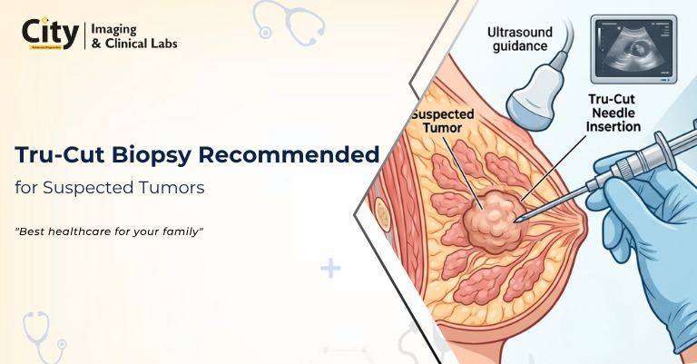 Tru-Cut Biopsy for Tumor