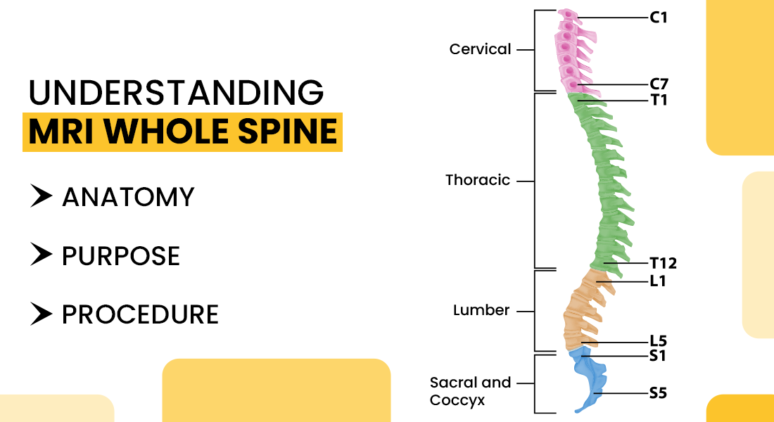 What is MRI of Whole Spine and Anatomy, Cost, and Purpose
